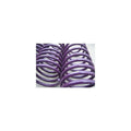 Lowering Springs Civic (i