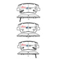 DBA 17-20 Hyundai Elantra (w/280mm Front Rotor) 2.0L Front SSEV Street Series Brake Pads