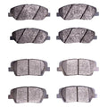 DFC auto part