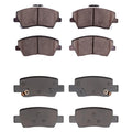 R1 17-22 Hyundai Elantra Front R1 Optimum OE Brake Pads