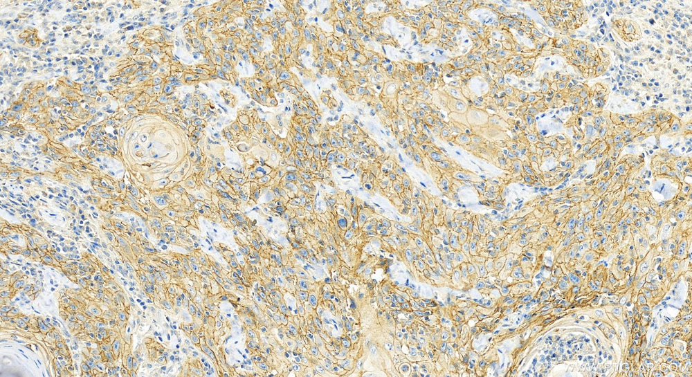 COVERKING silver auto part
