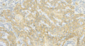 DASHCV SILVER POLY C99-05