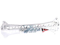 Rear Subframe Brace