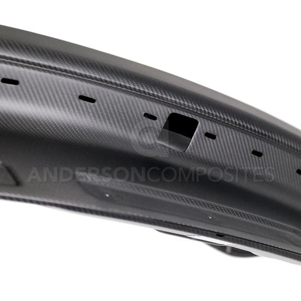 Dry Carbon Fiber Supercharger Kit